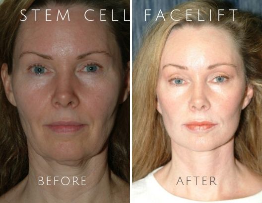 stemclient_c_1.stemclient_c_1-2-blog-ba-img