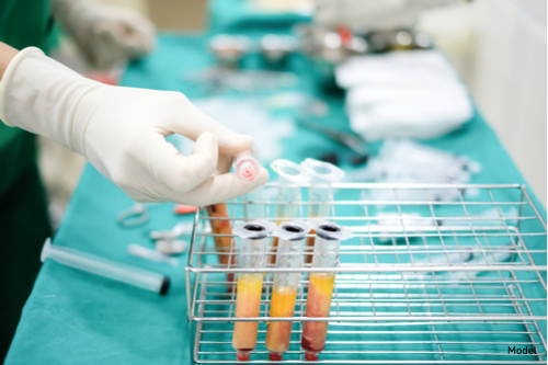 Hands with Sterile Gloves Working with Fat Tube in Stainless Rack and Other Medical Tools as Background